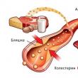 Cholesterolis: kaip vartoti?