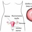 Vajinanın klinik belirtileri Ateşleme süreçleri ve enfeksiyonlar